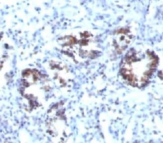 Monoclonal Mouse anti-Human TAGLN / Transgelin / SM22 Antibody (clone SPM606, IHC, IF)