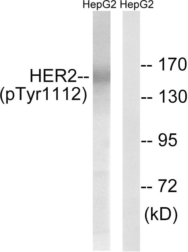 Polyclonal Rabbit anti-Human ERBB2 / HER2 Antibody (phospho-Tyr1112, WB)