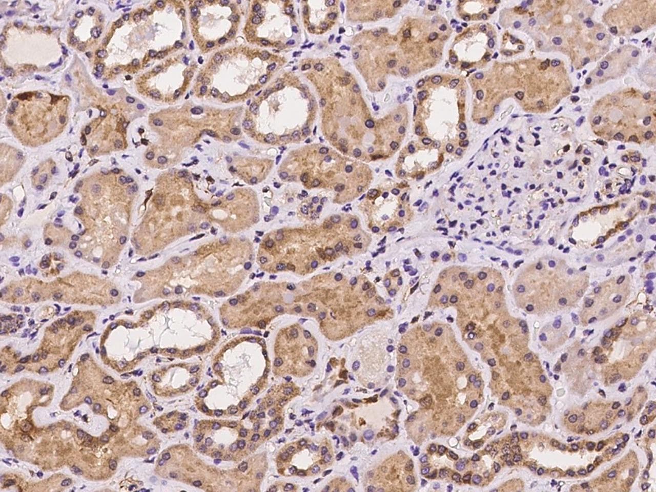 LMCD1 Antibody