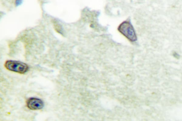 Polyclonal Rabbit anti-Human DLGAP1 Antibody (Glu817, IHC, IF, WB)