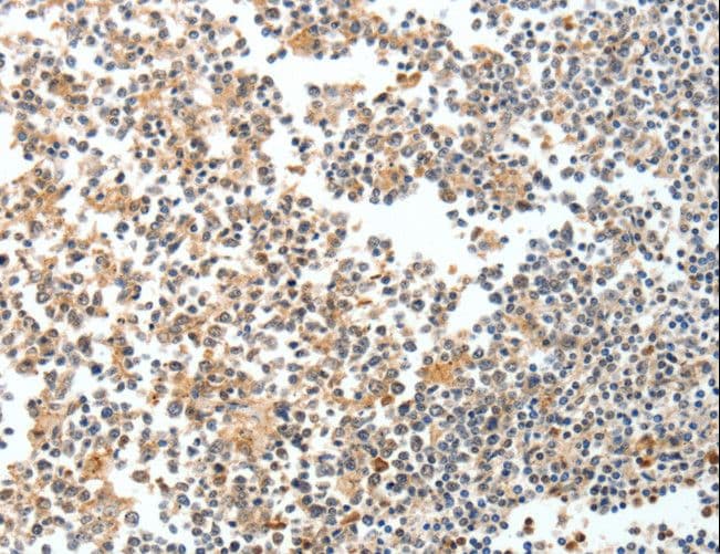 PDEF / SPDEF Antibody