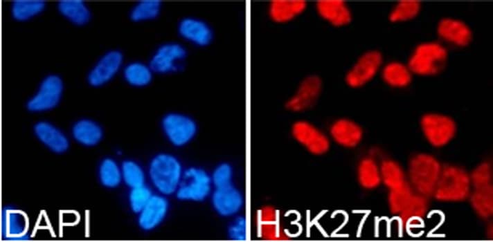 Histone H3 Antibody (Dimethyl-Lys27)