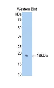 SUOX / Sulfite Oxidase Antibody (aa397-540)