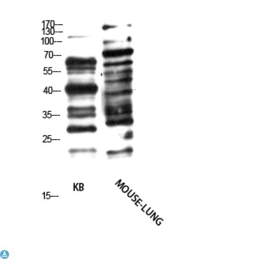 Anti Pan- myristoylation Antibody Antibody