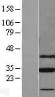 SLC25A18 Protein (Over-Expression Lysate Myc-DDK (Flag))