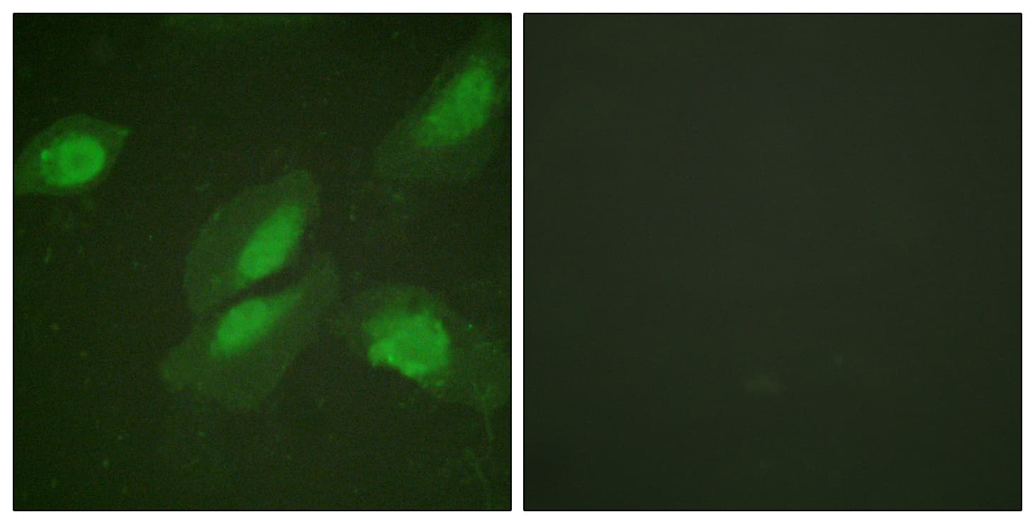 AKT1 Antibody (aa292-341)