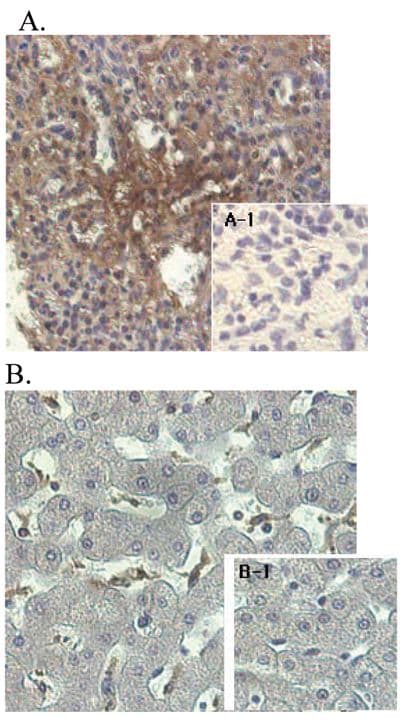ANGPTL4 Antibody (clone Kairos-1)
