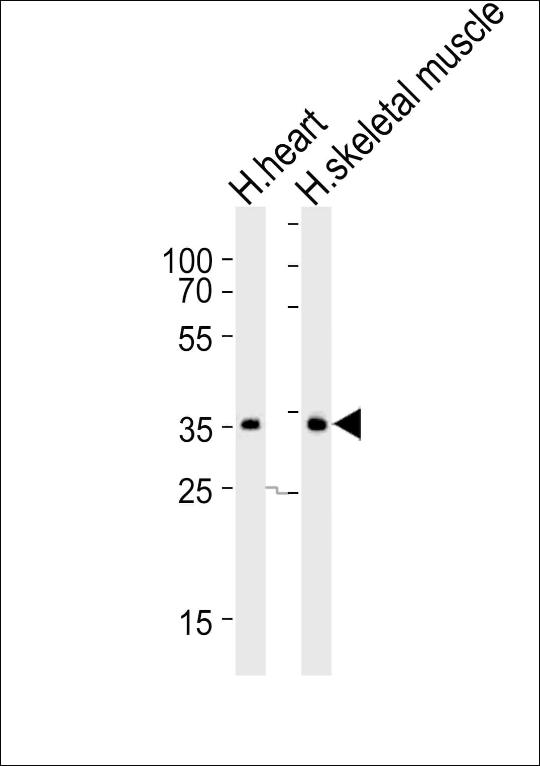 DIO2 Antibody (aa165-191)