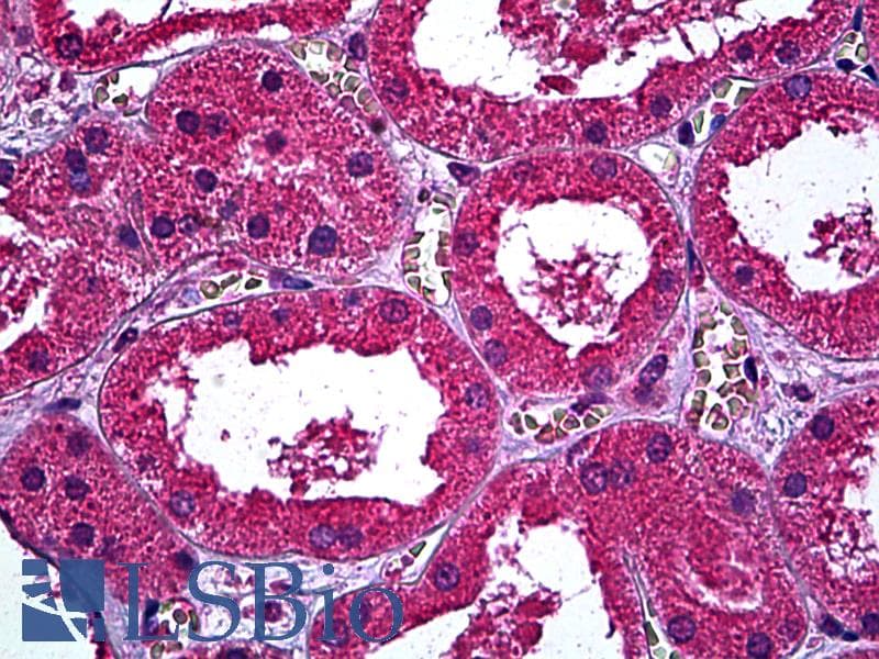 IHC-plus™ Monoclonal Mouse anti-Human ERBB3 / HER3 Antibody (clone 3F12, IHC)