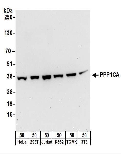 IHC-plus™ Polyclonal Rabbit anti-Human PPP1CA / PP1-Alpha Antibody (aa280-C-term, IHC, WB)