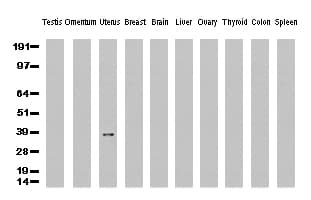 ERCC1 Antibody (clone 2.00E+12, Carrier-free)