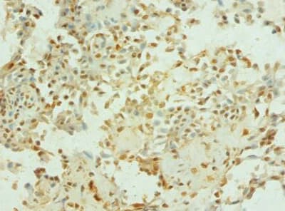 PTEN Antibody