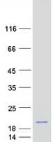 Human C1D Protein (Recombinant Myc-DDK (Flag))