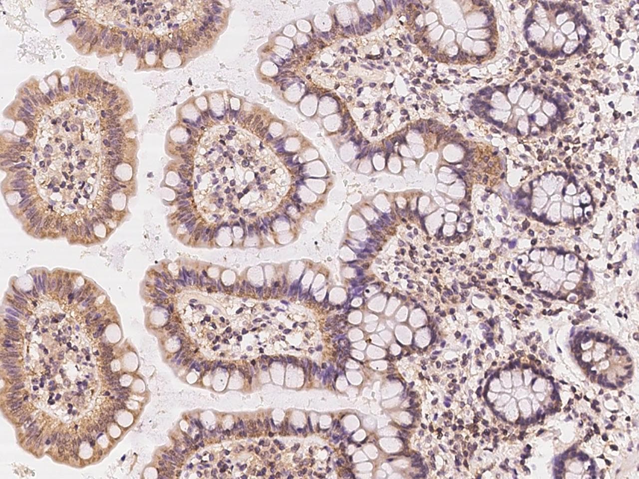 Polyclonal Rabbit anti-Human PAPLN Antibody (IHC)