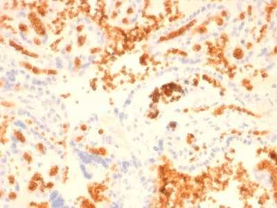 Recombinant Monoclonal Mouse anti-Human SPTA1 / Alpha Spectrin Antibody (clone rSPTA1/1833, aa356-475, IHC, WB)