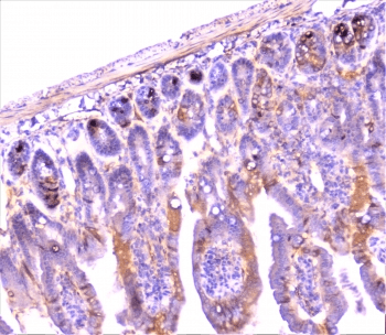 Polyclonal Rabbit anti-Human CRP / C-Reactive Protein Antibody (IHC, WB)