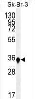 SIP / TP53INP1 Antibody (aa36-64)