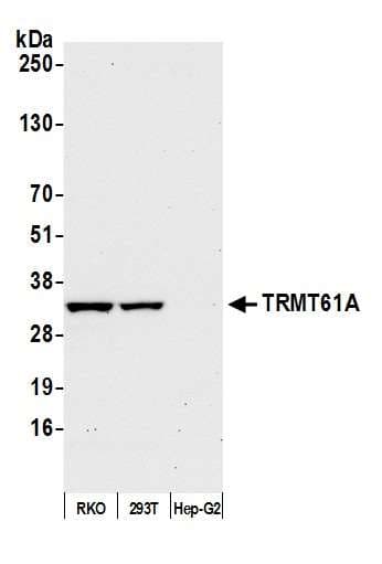 TRMT61A / TRM61 Antibody (aa239-289)