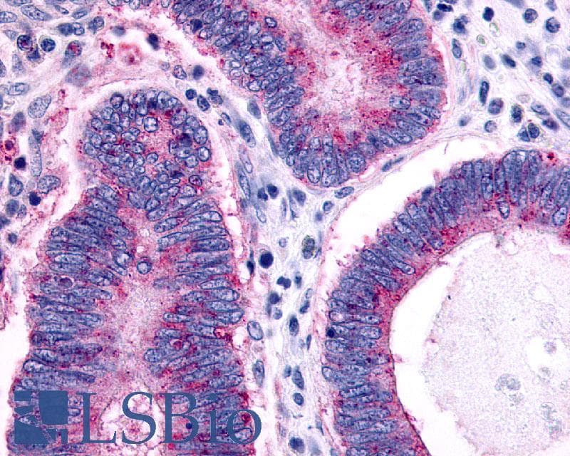 PathPlus™ CCR1 Antibody (Extracellular Domain)