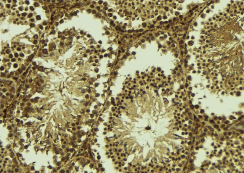 Polyclonal Rabbit anti-Human CENPU / MLF1IP Antibody (IHC, WB)