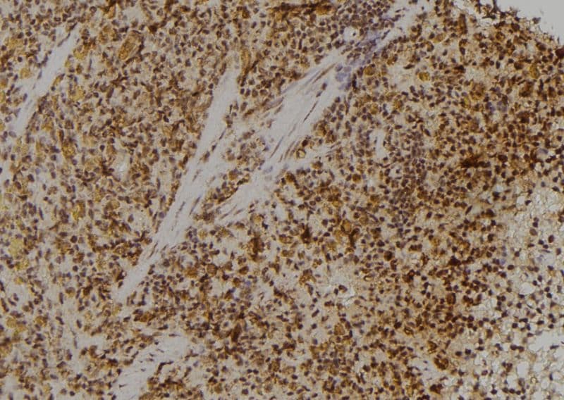 RPL23 / Ribosomal Protein L23 Antibody