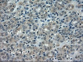 IHC-plus™ CRYAB / Alpha B Crystallin Antibody (clone 6D11)