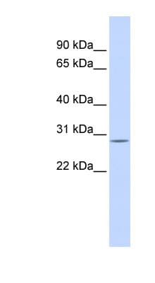 SCEH / ECHS1 Antibody (aa36-85)