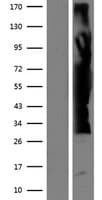 ZFYVE19 Protein (Over-Expression Lysate Myc-DDK (Flag))