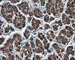 Monoclonal Mouse anti-Human BRAF / B-Raf Antibody (clone OTI1E2, IHC, IF, WB)
