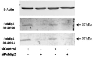 POLDIP2 / PDIP38 Antibody (aa335-347)