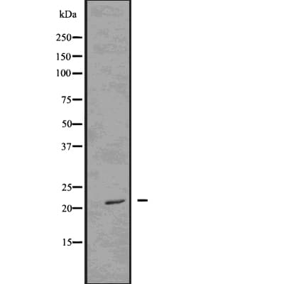 Polyclonal Rabbit anti-Human FADD Antibody (phospho-Ser194, IF, WB)