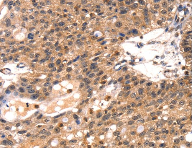 TLN1 / Talin 1 Antibody