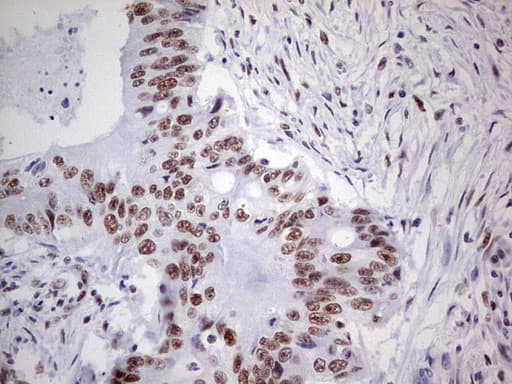 PPP1R8 / Rnase E Antibody (aa1-225, clone OTI5H9)