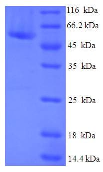 Human CIAO1 Protein (Recombinant His-SUMO)