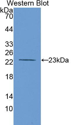 MMP12 Antibody (aa100-286)
