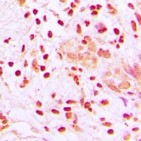 Polyclonal Rabbit anti-Human HSF1 Antibody (Internal, IHC, IF, WB)