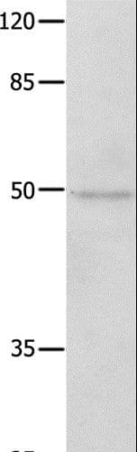 Polyclonal Rabbit anti-Human NAP1L1 Antibody (IHC, WB)
