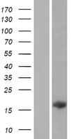 C14orf181 Protein (Over-Expression Lysate Myc-DDK (Flag))