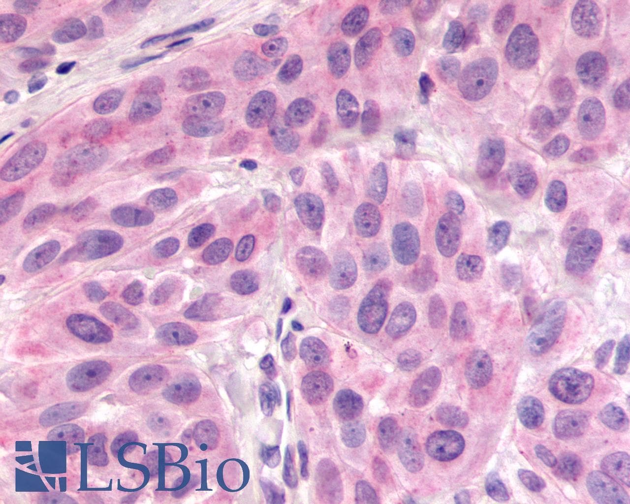 IHC-plus™ Polyclonal Rabbit anti-Human ADGRV1 / GPR98 Antibody (N-Terminus, IHC, WB)