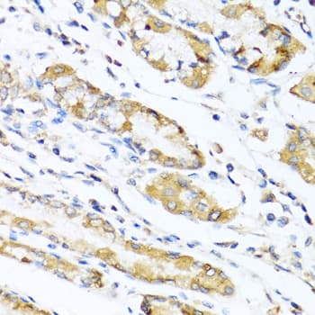 LYZ / Lysozyme Antibody