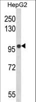 BANK1 / BANK Antibody (aa119-146)