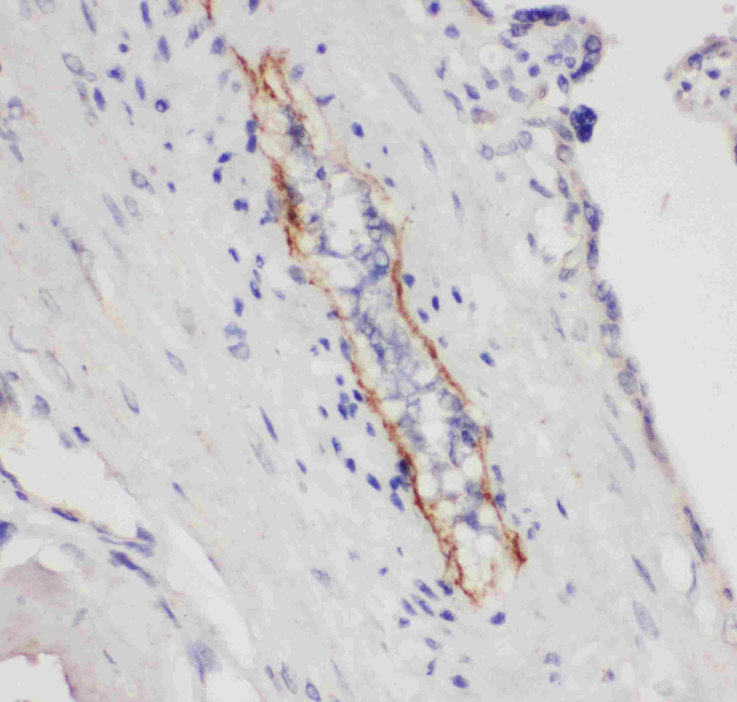 SELP / P-Selectin / CD62P Antibody (aa49-66)