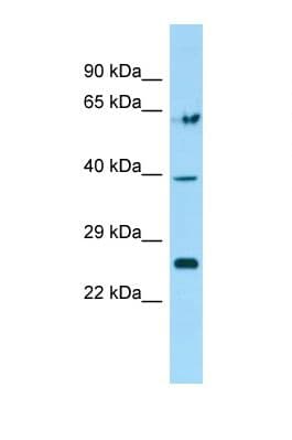 TGIF2 Antibody (N-Terminus)