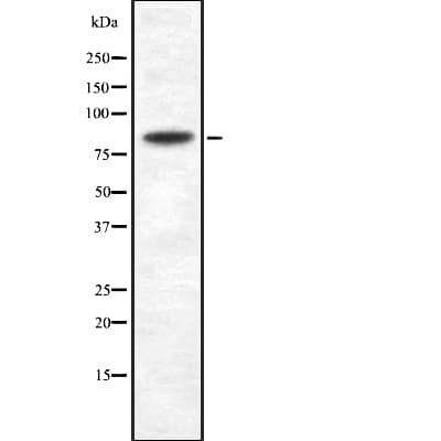 Polyclonal Rabbit anti-Human SEMA3A / Semaphorin 3A Antibody (IHC, WB)