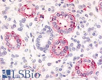 IHC-plus™ FZD2 / Frizzled 2 Antibody (Extracellular Domain)