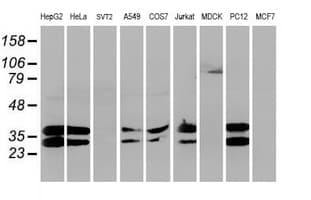 UNG / Uracil DNA Glycosylase Antibody (clone OTI2C12)