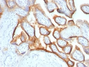 CGA / hCG Alpha Antibody (clone SPM552)