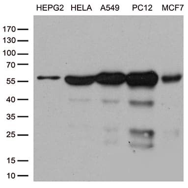 PPP3CA / CCN1 / Calcineurin A Antibody (aa2-105, clone OTI5C6)