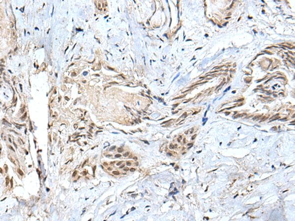 SMC1A / SMC1 Antibody