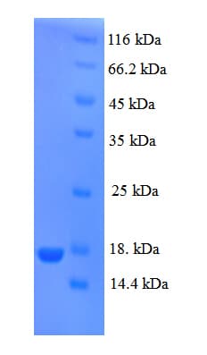 Human PIP / GCDFP-15 Protein (Recombinant His)
